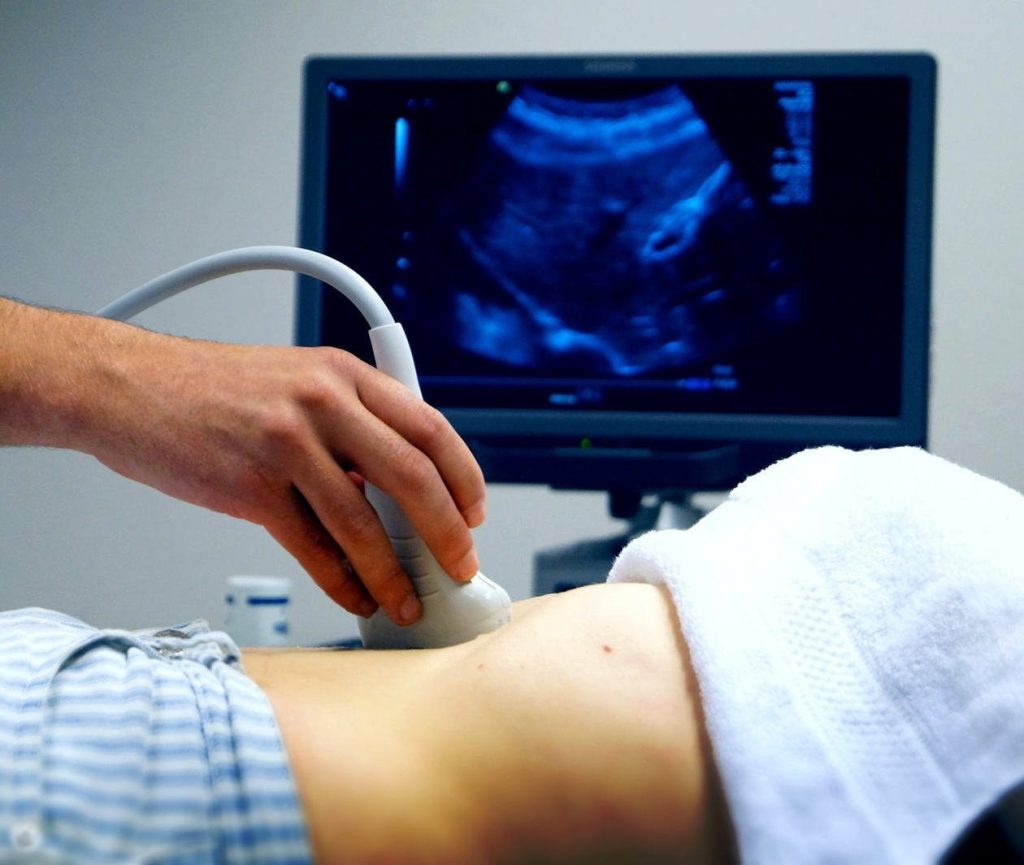 Define the Major Requirement of Ultrasound Services